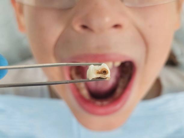Best Emergency Treatment for Toothache in Pomona Park, FL